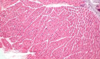 IPSC Therapy Designed to Deliver Full-length Dystrophin Gets Orphan Drug Designation for DMD
