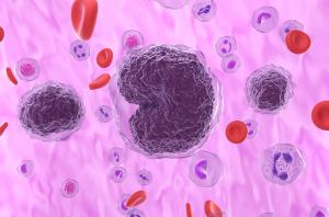 Top News in Lymphoma Cell Therapy for World Lymphoma Awareness Day 2025