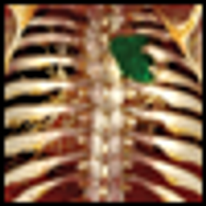 Should maintenance therapy serve as the standard of care in metastatic non-small-cell lung cancer?