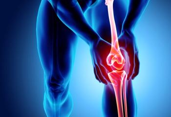 MSC Therapy Improves Pain, Stiffness, Function in Osteoarthritis Compared to Placebo
