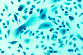 prostate cancer cells