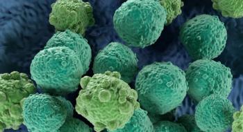 lymphoma