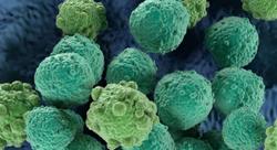 Allogeneic Anti-CD7 CAR-T Demonstrates Promising Results in Hematological Malignancies 
