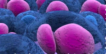 Microscopic image of multiple myeloma