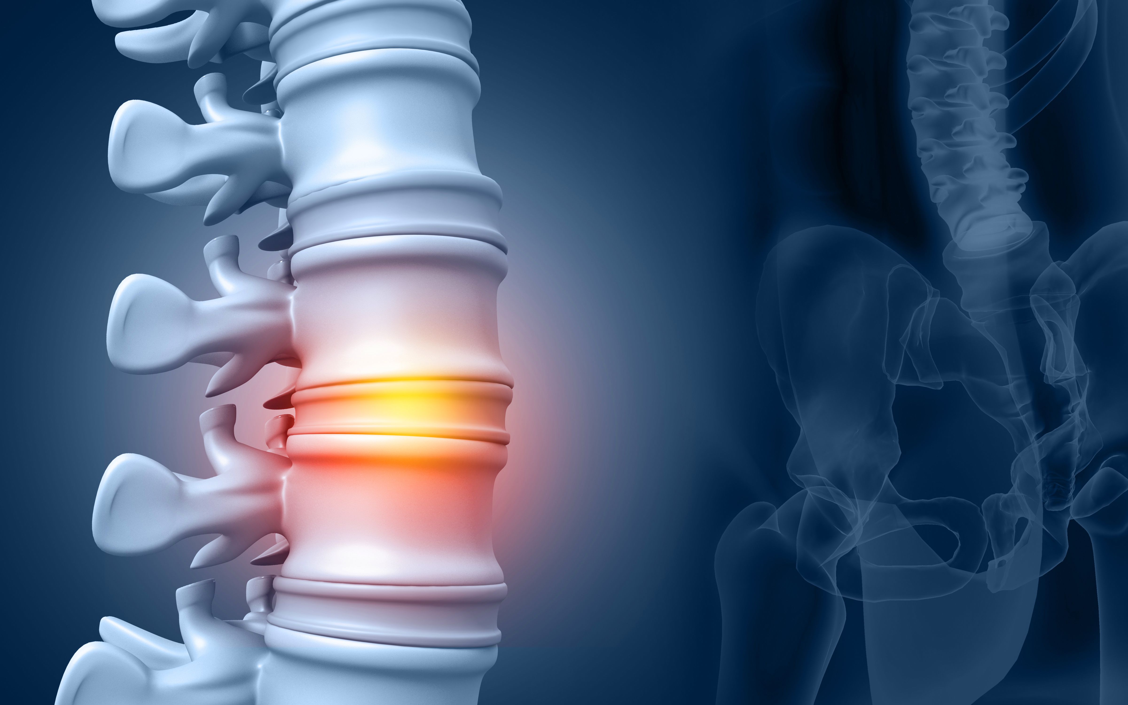 Sisc Lumb DiscGenics’ Discogenic Progenitor Cell Therapy Rebonuputemcel Cleared ...