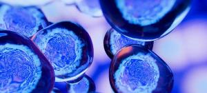 Mesenchymal Stem Cell Therapy an Option for Patients With Type 2 Diabetes Complications