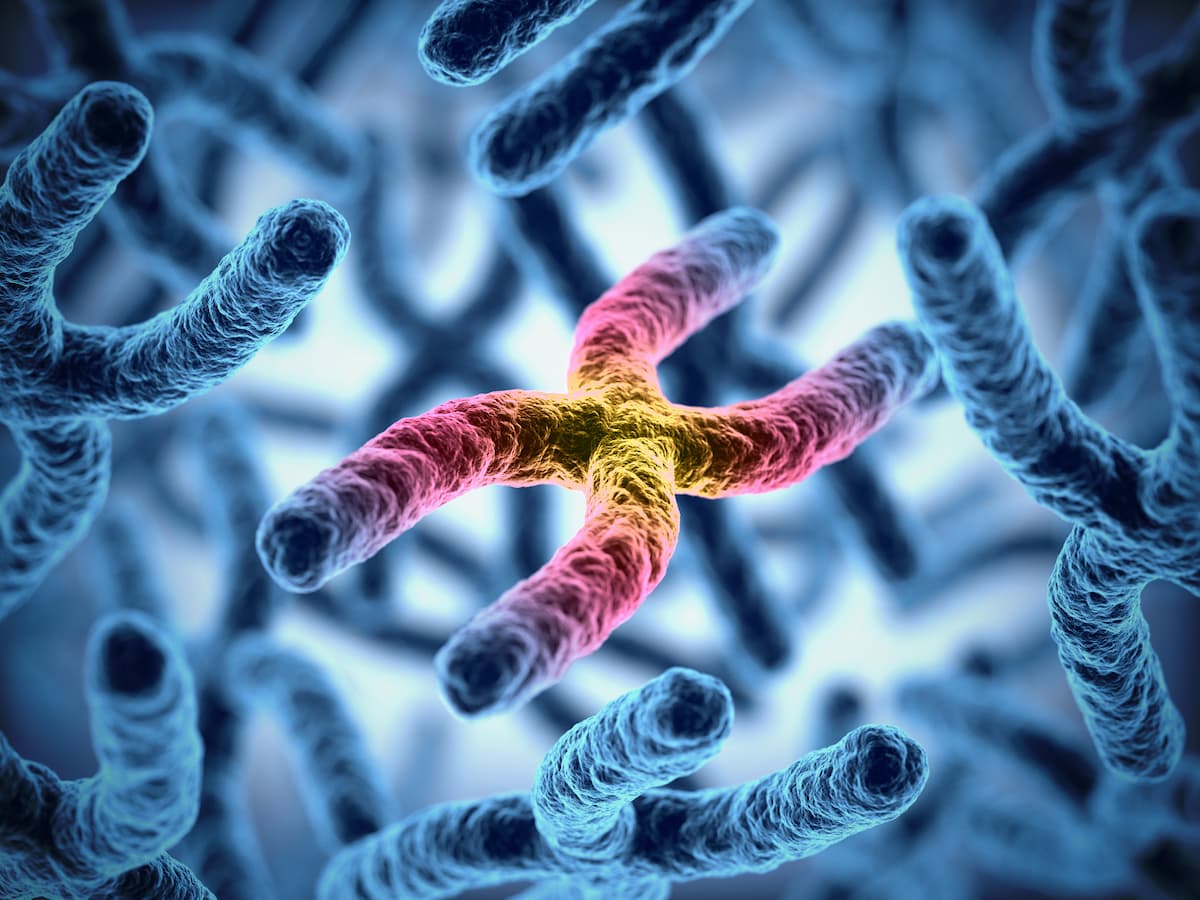 Lentiviral Gene Therapy Stabilizes Patients With MPS1H