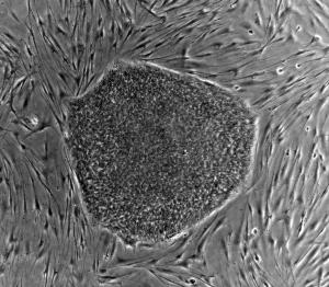 Unapproved Stem Cell Therapies Are Causing "Dismal" Health Outcomes