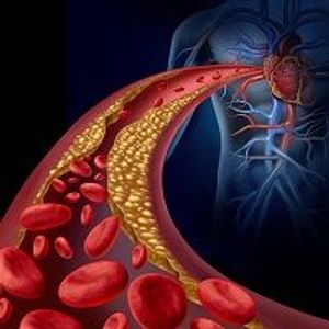 How PCSK9 Moved from Gene to Therapy and What Comes Next