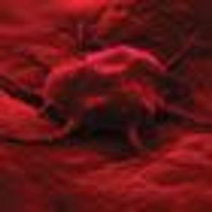 Chimeric Antigen Receptor (CAR) T-Cell Immunotherapy for Leukemia and Beyond