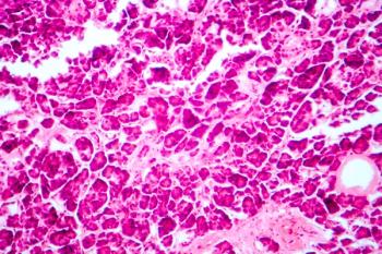 Patients With Type 1 Diabetes Independence Achieve Insulin Independence With Islet Cell Therapy  