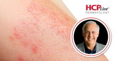 3-Year Patient-Reported Psoriasis Outcomes for Bimekizumab, With Ron Vender, MD