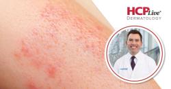 Together-PsA: Ixekizumab + Tirzepatide Deliver Superior Efficacy Over Biologic Monotherapy, With Joseph Merola, MD