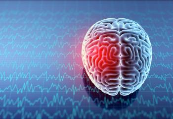 Stroke Treatment Without Thrombolytic Therapy, New Research