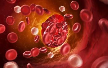 Blood clot blocking an artery.