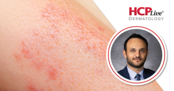 When to Refer a Patient for Systemic Mastocytosis, With Hussein Abbas, MD, PhD