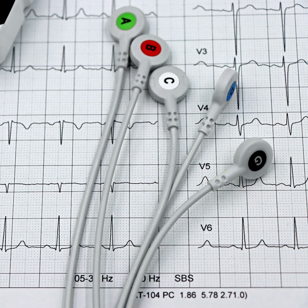 Liver Stiffness and Fat Content May Lead to Coronary Heart Disease, Study Suggests Liver Stiffness and Fat Content May Lead to Coronary Heart Disease, Study Suggests