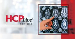 Which LVO Stroke Patients Benefit from Edaravone Dexborneol Before EVT?