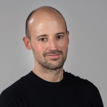 Real-World Data Support Baricitinib Use for Atopic Dermatitis, Alopecia | Image Credit: University of Bordeaux