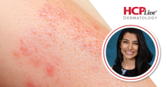 Chronic Hand Eczema: A Clinical Forum Recap, With Radhika Shah, MD