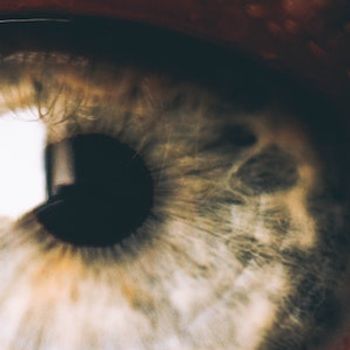 Adverse Event Data Mining Finds Few Ocular Side Effects From PCSK9 Inhibitors