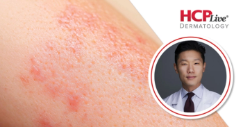 3 Tips for Managing Skin Disease in Dermatology Practice, With Eingun James Song, MD