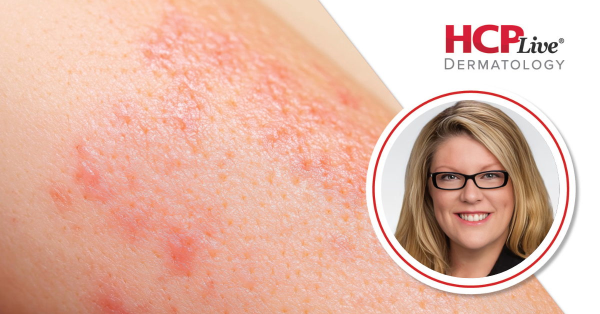 How Dermatology PAs Can Master Rapid Diagnostic Recognition
