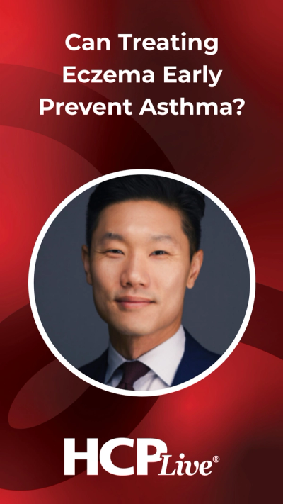 Can Treating Eczema Early Prevent Asthma?
