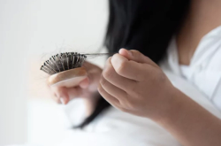 Real-World Study Affirms Baricitinib’s Efficacy for Alopecia Areata