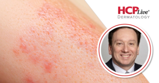 Discussing AI Scribes and Improving Billing Practices in Dermatology, With Mark Kaufmann, MD