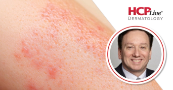 Discussing AI Scribes and Improving Billing Practices in Dermatology, With Mark Kaufmann, MD