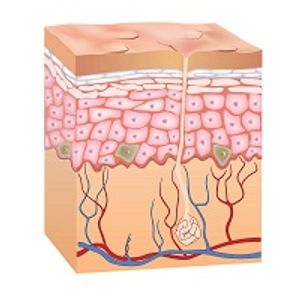 Managing Urticaria: New Guidelines and Beyond 