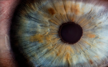 Vision Loss Will Increase in Brazil, Russia, India, China, South Africa by 2040