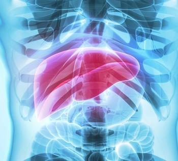 HCC in hepatitis C infected liver | Credit: Adobe Stock
