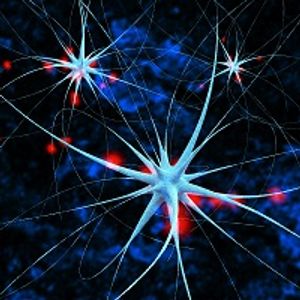 Neurobiology of Addiction: PET Scans Show Changes in the Brain. 
