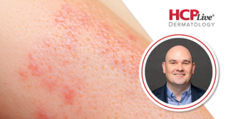 Prior Authorization, Precision Medicine, and Eczema Remission, With Jason Hawkes, MD