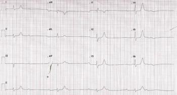 EKG readout