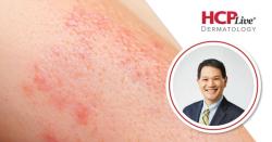 Shared Decisions, Better Outcomes in Atopic Dermatitis, With Weily Soong, MD