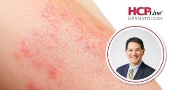 Shared Decisions, Better Outcomes in Atopic Dermatitis, With Weily Soong, MD