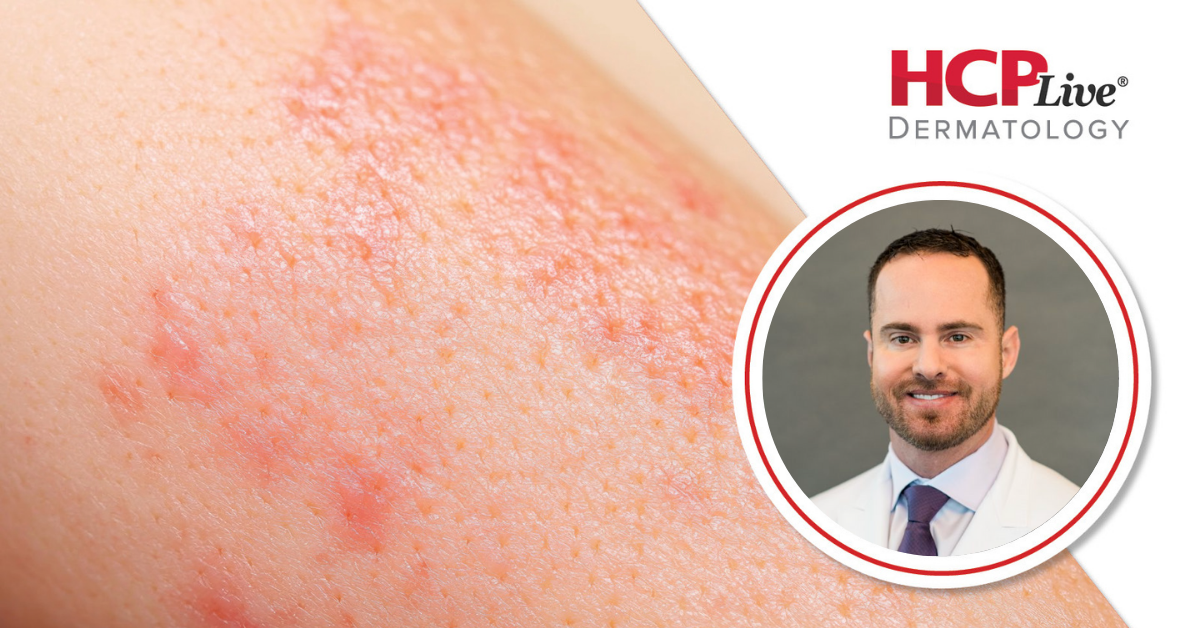 Is Social Media Necessary for Dermatology Clinicians? With Joseph Gatti, DMSc, MPAS, MBA, PA-C