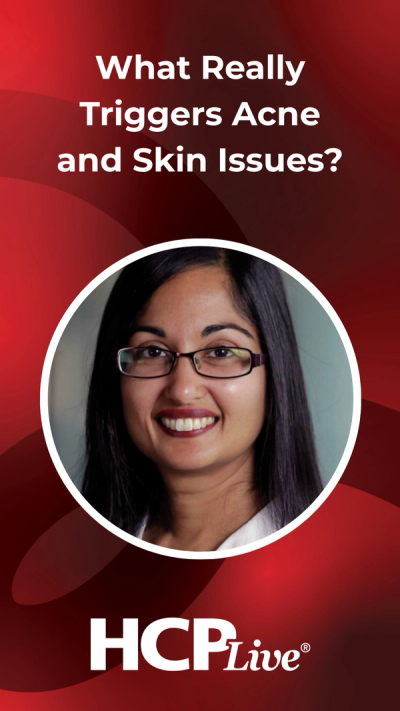 What Really Triggers Acne and Skin Issues?