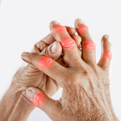 Personalizing Gout Management, with Priya Reddy, MD
