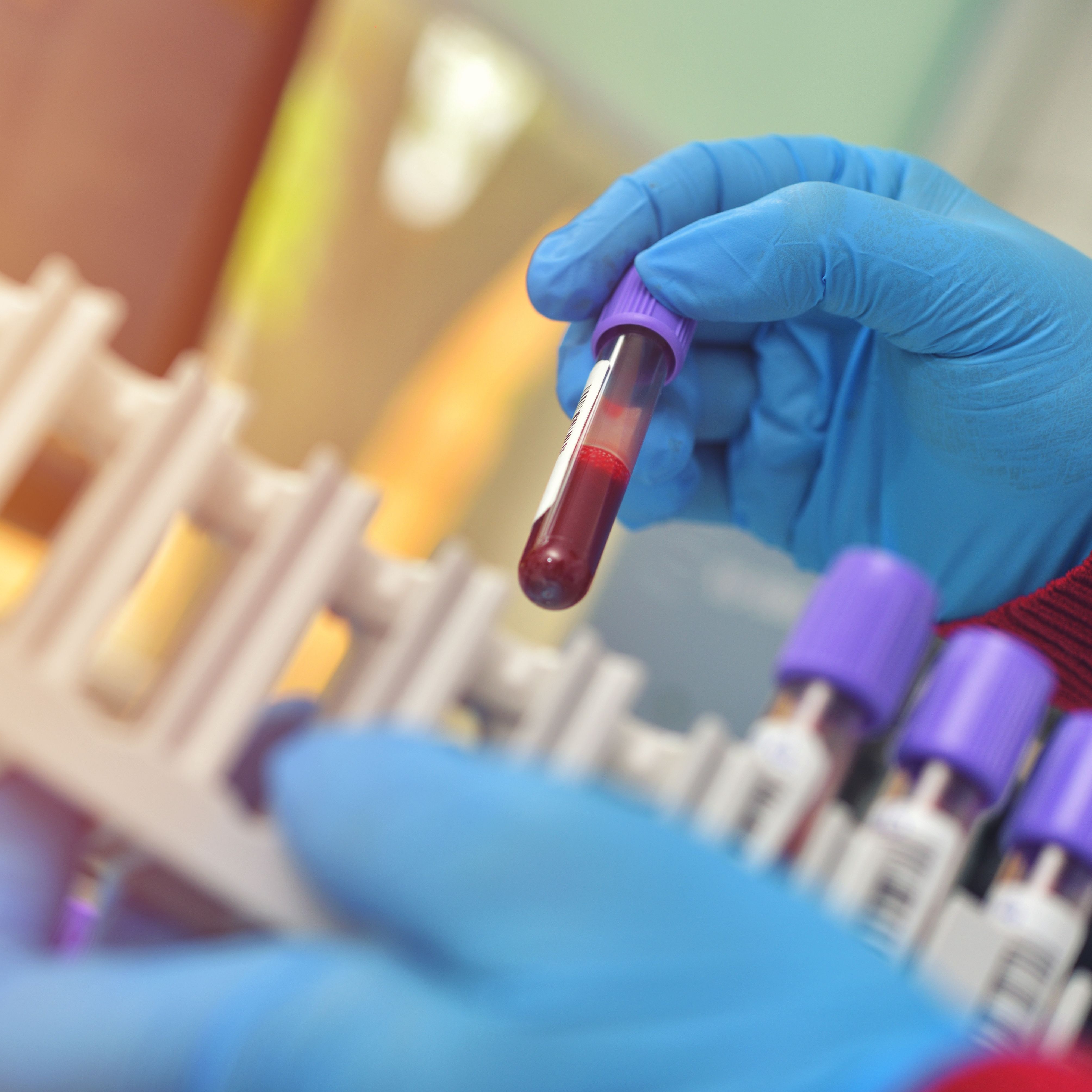 Znajomość nasilenia, kształtowania percepcji podatności na test cechy anemii sierpowatej