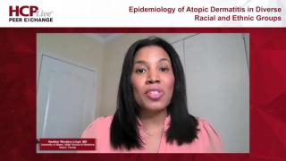 Atopic Dermatitis in Diverse Racial and Ethnic Groups