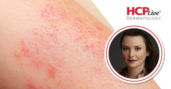 Skin Imaging Data on Dupilumab for Atopic Dermatitis in Skin of Color, With Orit Markowitz, MD