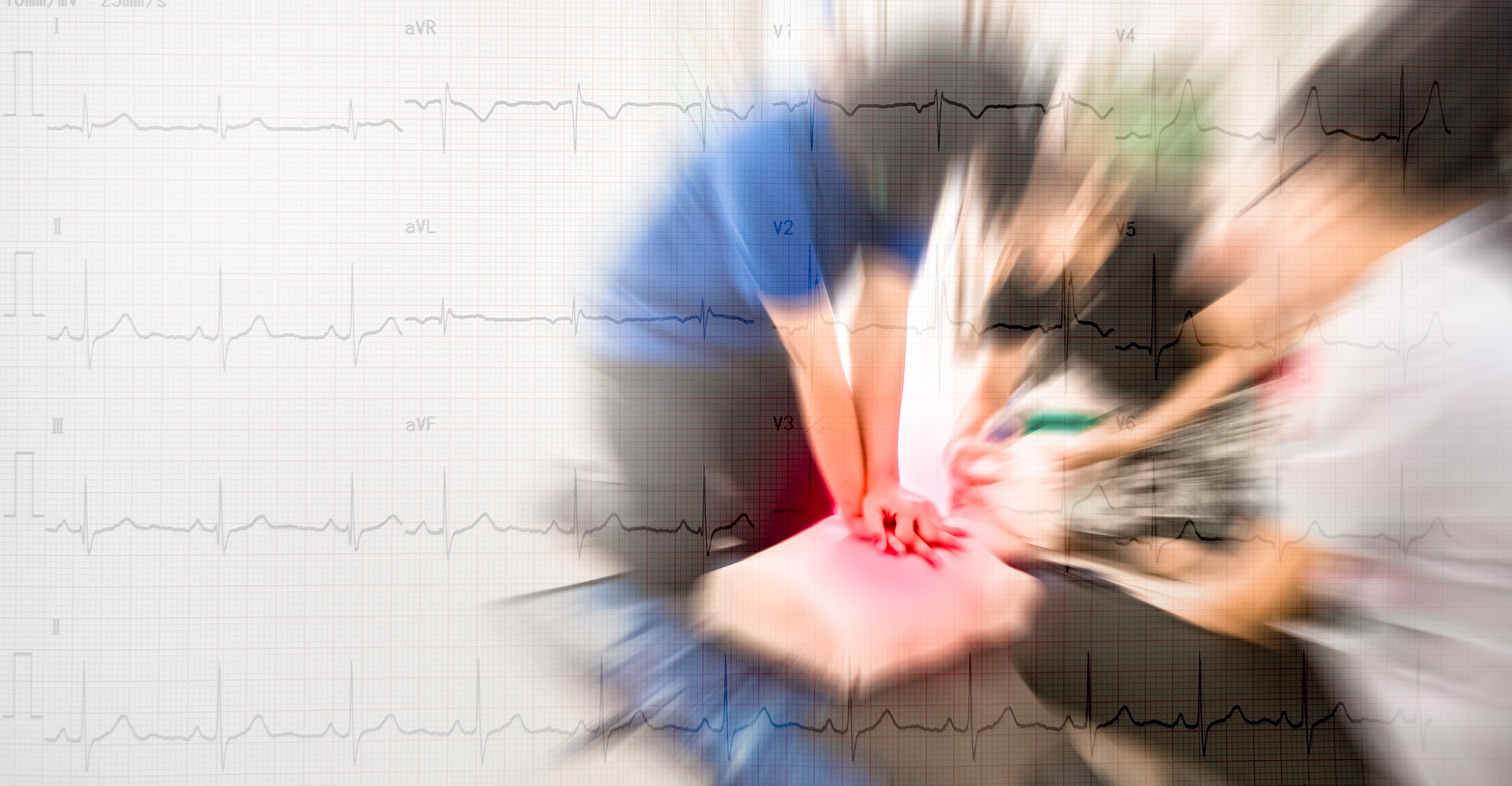 COVID-19: Protecting First Responders and Bystanders During Emergency CPR