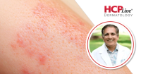 Neal Bhatia, MD | Image credit: Therapeutics Dermatology