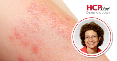 How Does the FDA Approval of Risankizumab Impact Pediatric Psoriasis and PsA? With Amy Paller, MD