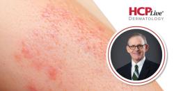 Advantages of Photodynamic Therapy with 10% ALA Gel in Basal Cell Carcinoma, With M. Shane Chapman, MD, MBA