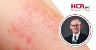 Going Deeper With Photodynamic Therapy for BCC, With M. Shane Chapman, MD, MBA